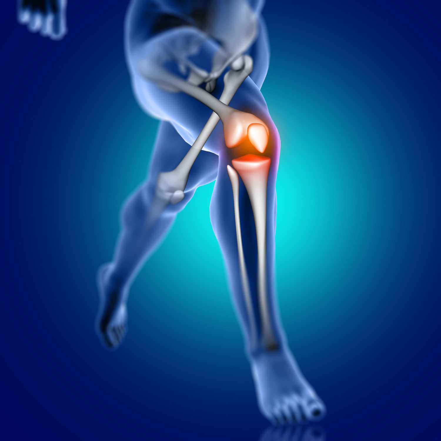Illustration representing hip and knee joint replacement surgery